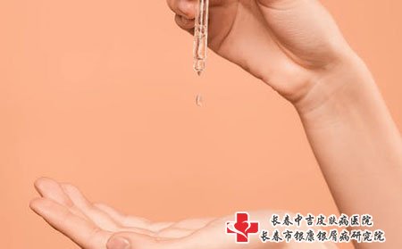 长春牛皮癣医院哪家好,长春中吉牛皮癣医院,长春治牛皮癣专科医院