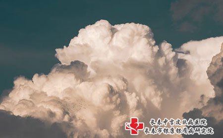 长春中吉牛皮癣医院谈不治疗牛皮癣的6个伤害