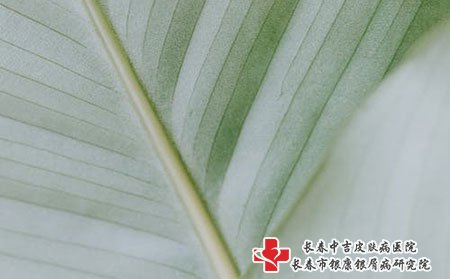 什么原因引发的牛皮癣
