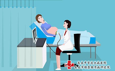 牛皮癣用什么办法治疗好