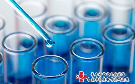 身上有牛皮癣怎么治才好