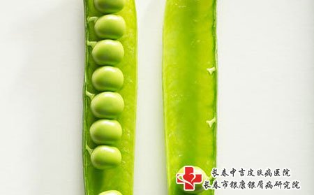 患者在哪些方面着重注意会加快牛皮癣的治疗