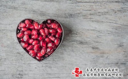 长春哪家医院治疗牛皮癣的效果好?