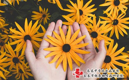 小面积牛皮癣的治疗的注意事项