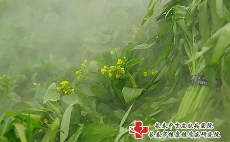 长春中吉治疗牛皮癣的专科研究院评价